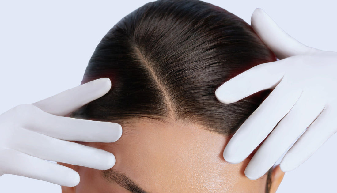 Hair Thinning and Hair Loss