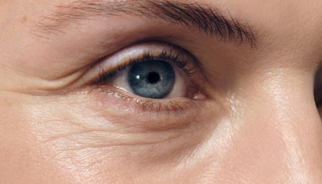 Lines and Wrinkles