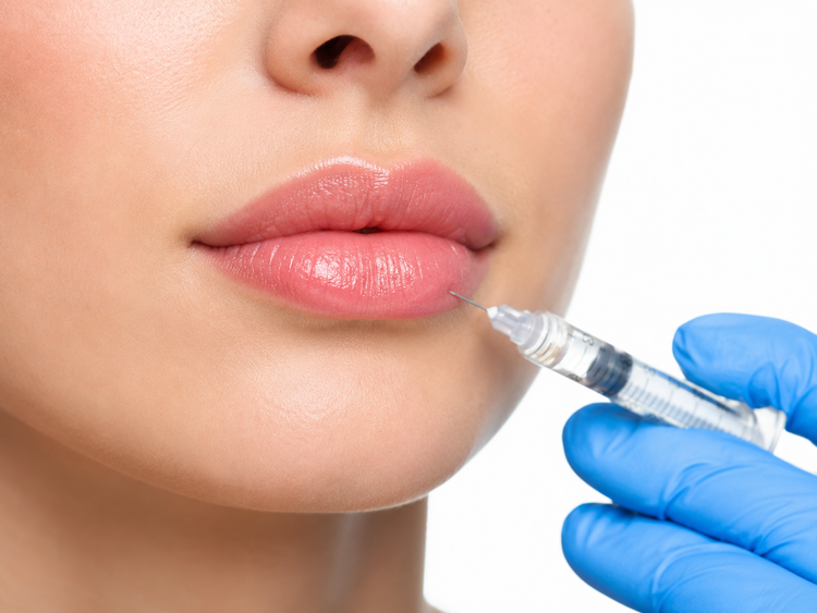 Dermal Fillers