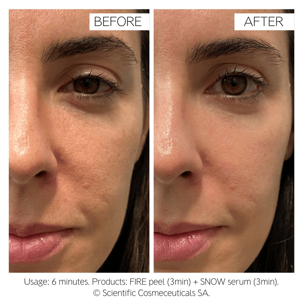 Dr Levy Fire & Snow Peel & Serum 20 day protocol (4 x 10ml)
