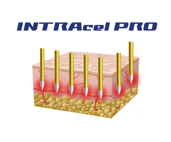INTRAcel Pro™