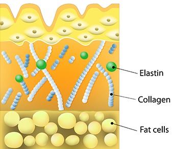 What Causes Loss of Firmness? 